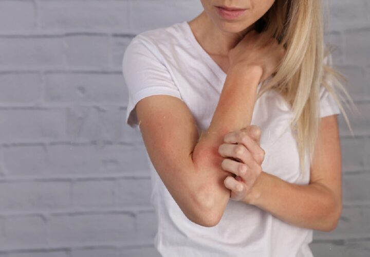 Natural Eczema Treatment For You To Pursue